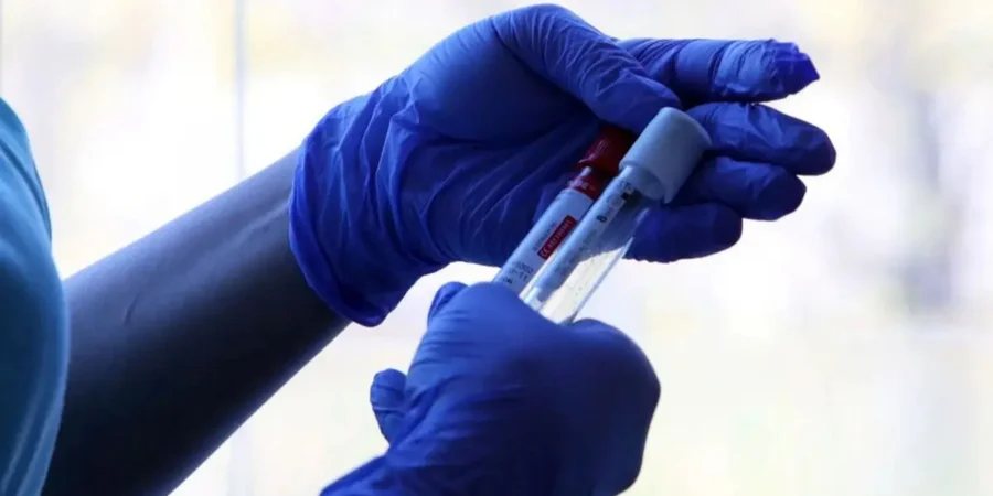 В Іркутську померла співробітниця лабораторії, яка вивчає чуму